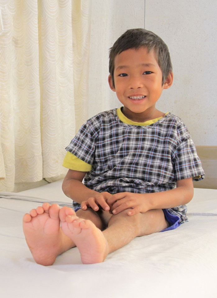 In Nepal, Ramsaran received life-changing clubfoot surgery and rehabilitation at a cbm-partnered hospital.]