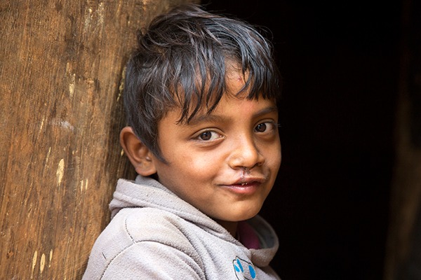 In Nepal, Dinesh received a life-changing prosthetic limb and rehabilitation at a cbm-funded hospital.]