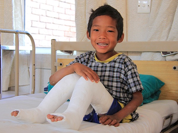 Five-year-old Ramsaran smiling after receiving life-changing clubfoot surgery and rehabilitation at a cbm-funded hospital in Nepal