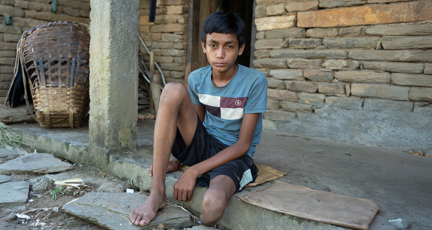 Sarbendra in Nepal receiving prosthetics and physical rehabilitation