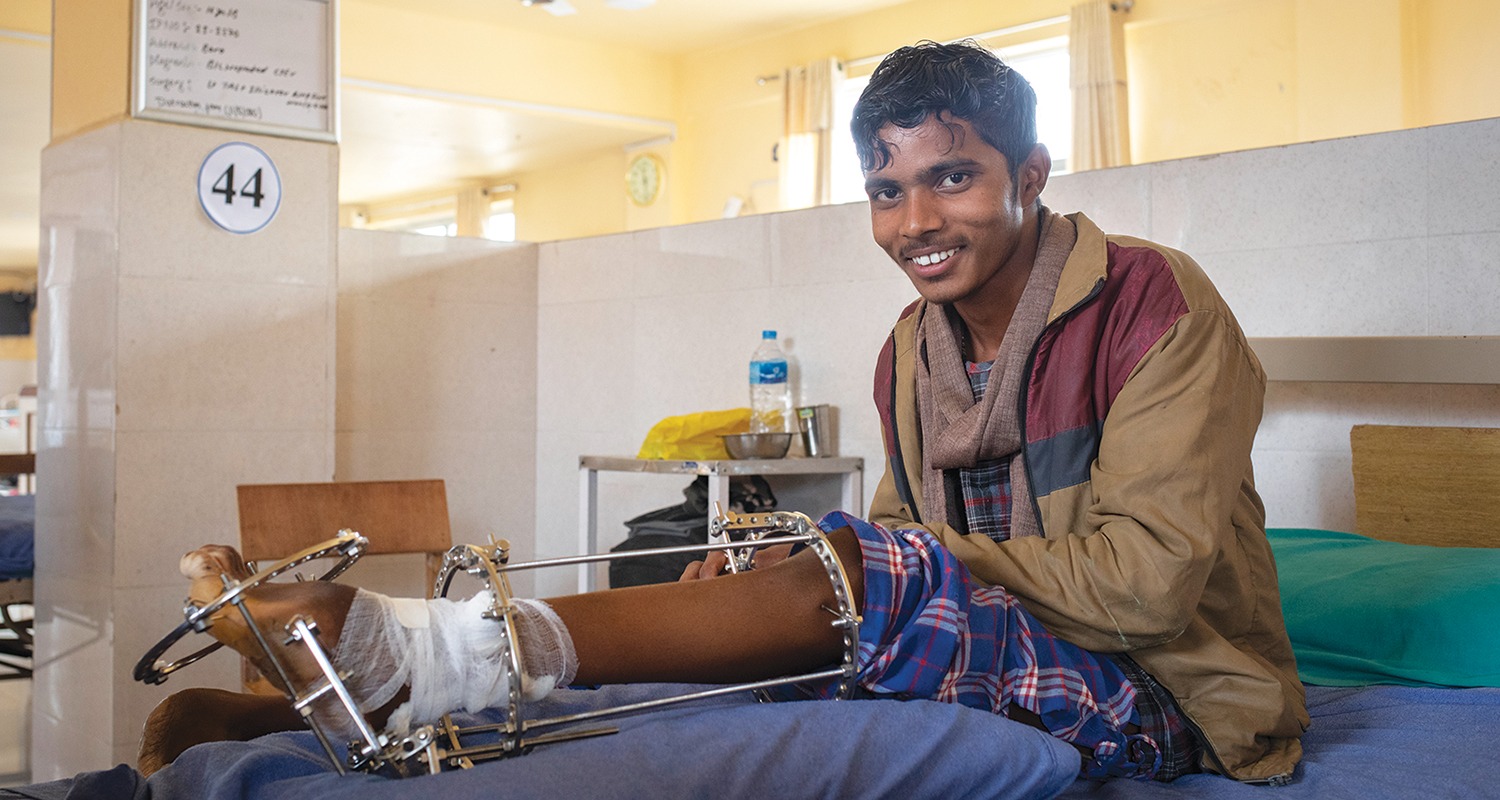 Jitesh in Nepal received surgery and physical rehabilitation for his severe clubfoot