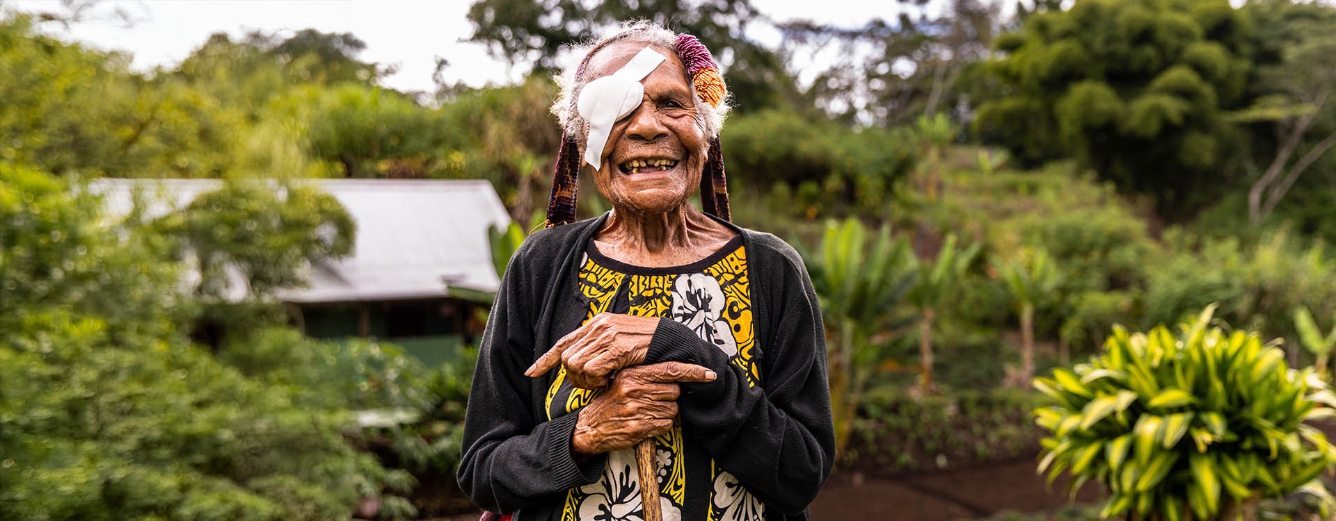 Gepeso received sight-saving cataract surgery at a cbm-funded hospital in Papua New Guinea