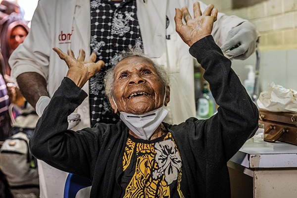 Gepeso received sight saving cataract surgery in the Highlands of Papua New Guinea.