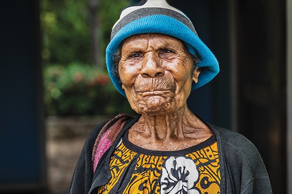 Gepeso needs sight saving cataract surgery in the Highlands of Papua New Guinea.