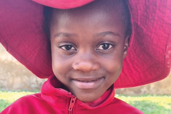 Camille in Zimbabwe needed sight-saving cataract surgery.
