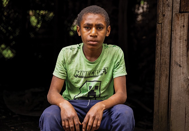 Patrick received sight saving cataract surgery in the Highlands of Papua New Guinea.