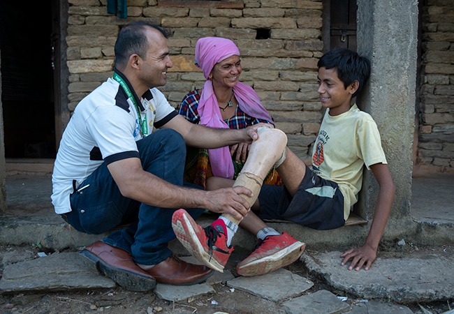 Sarbendra in Nepal receiving a new prosthetic limb and physical rehabilitation