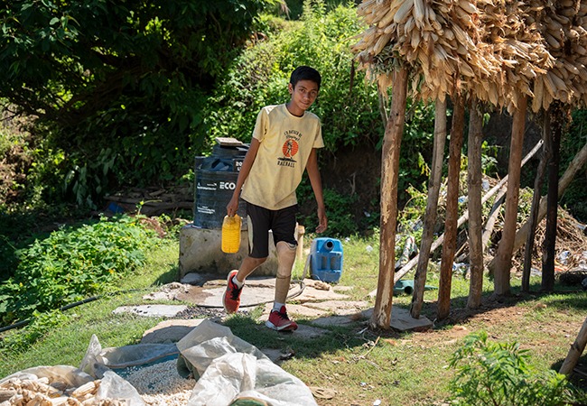 Sarbendra in Nepal receiving a new prosthetic limb and physical rehabilitation