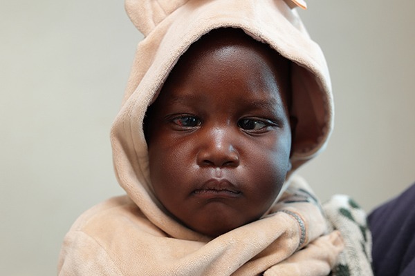 Nadiah in Zimbabwe awaiting sight-saving cataract surgery.