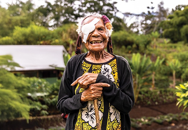 Gepeso received sight-saving cataract surgery at a cbm-funded hospital in Papua New Guinea