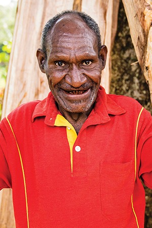 Huki in Papua New Guinea received sight-saving cataract surgery.