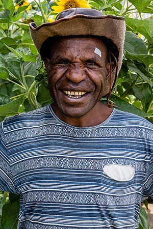 Steven in Papua New Guinea received sight-saving cataract surgery.